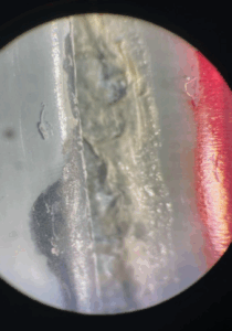 A microscopic photo of a can seam showing no visible damage or defects, despite being the suspected site of a leak.